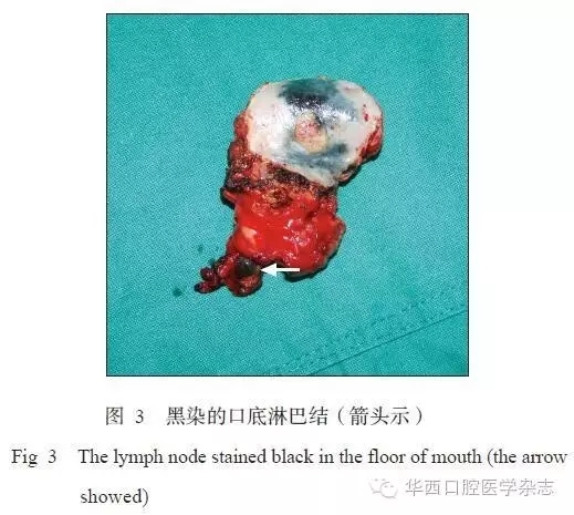 640.webp (2).jpg 640.webp (2).jpg