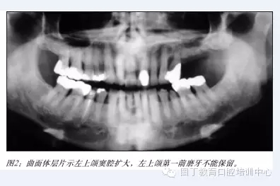 640.webp (1).jpg 640.webp (1).jpg