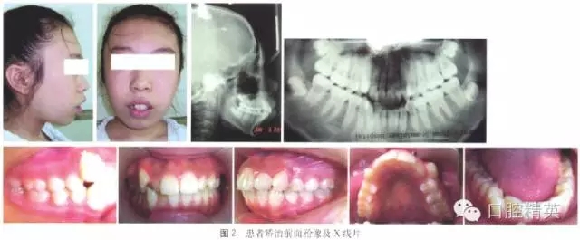 640.webp (1).jpg 640.webp (1).jpg