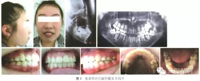 640.webp (4).jpg 640.webp (4).jpg