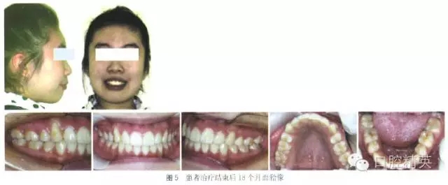 640.webp (5).jpg 640.webp (5).jpg