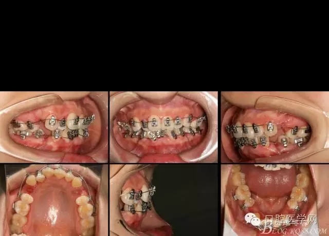 640.webp (2).jpg 640.webp (2).jpg