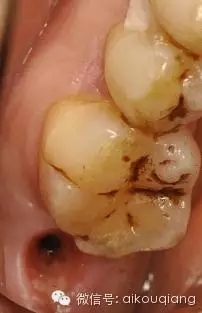 640.webp (3).jpg 640.webp (3).jpg