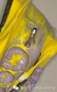 640.webp (5).jpg 640.webp (5).jpg