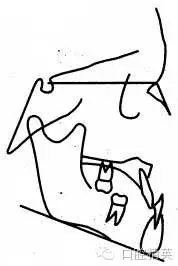 640.webp (8).jpg 640.webp (8).jpg