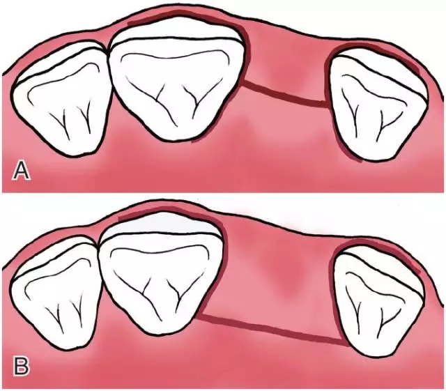 640.webp (4).jpg 640.webp (4).jpg