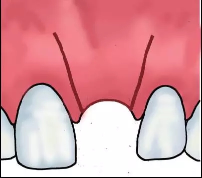 640.webp (6).jpg 640.webp (6).jpg