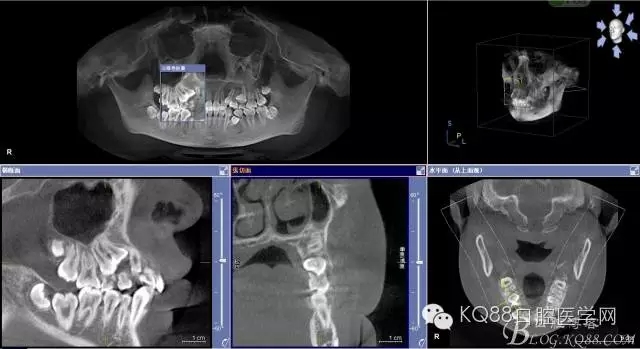 640.webp (4).jpg 640.webp (4).jpg