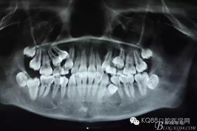 640.webp (5).jpg 640.webp (5).jpg