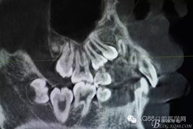 640.webp (6).jpg 640.webp (6).jpg