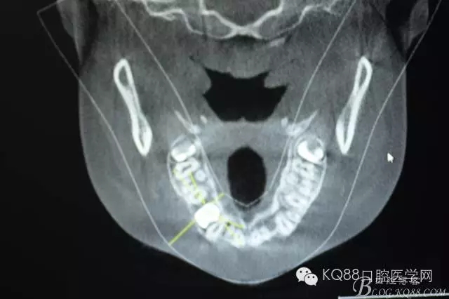 640.webp (7).jpg 640.webp (7).jpg