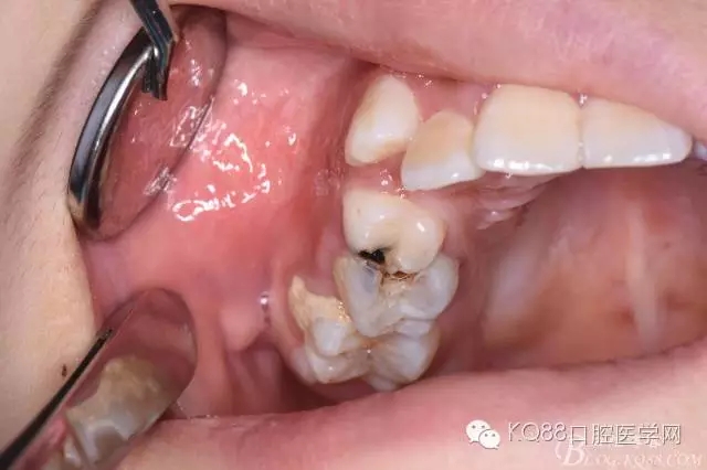 640.webp (8).jpg 640.webp (8).jpg