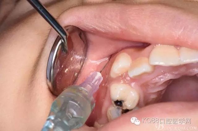 640.webp (10).jpg 640.webp (10).jpg