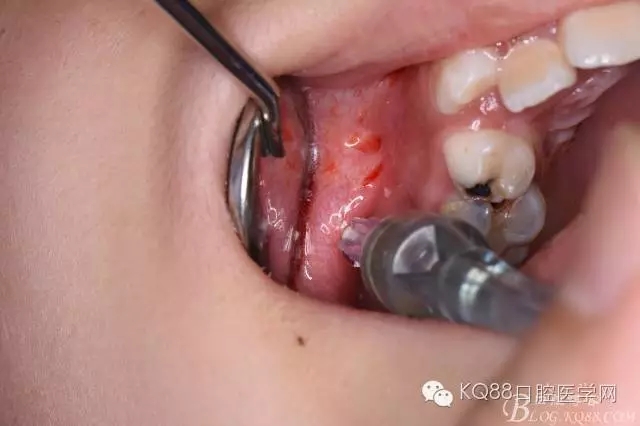 640.webp (11).jpg 640.webp (11).jpg