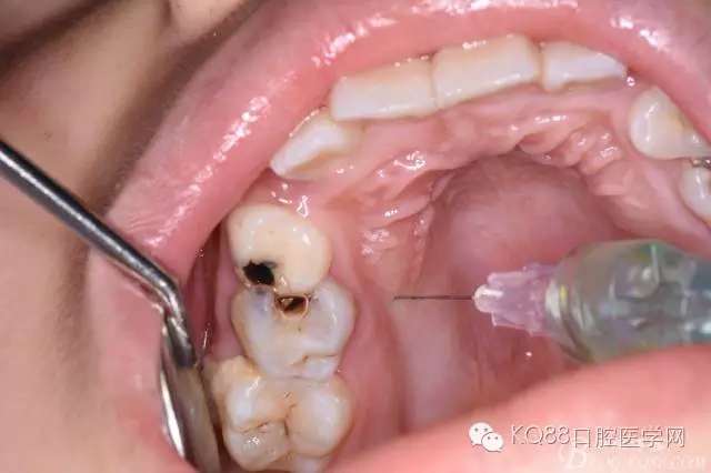 640.webp (12).jpg 640.webp (12).jpg