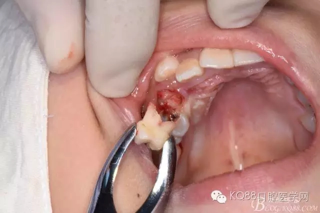 640.webp (14).jpg 640.webp (14).jpg