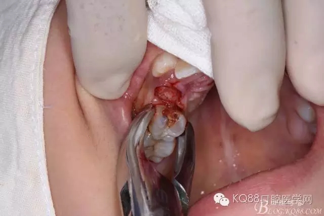 640.webp (15).jpg 640.webp (15).jpg