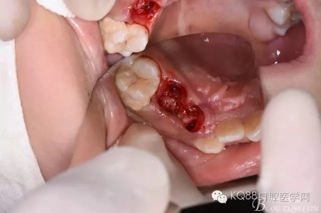 640.webp (16).jpg 640.webp (16).jpg