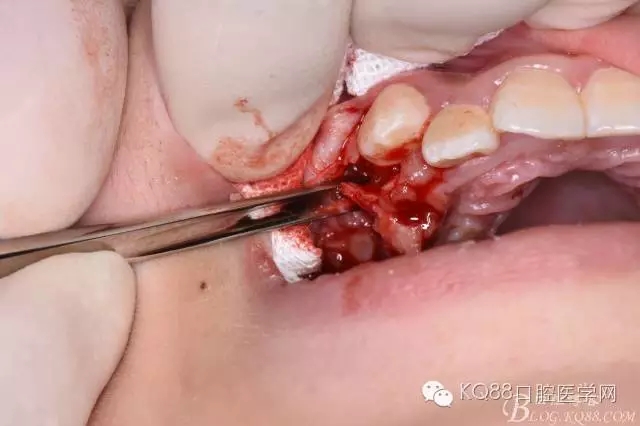 640.webp (17).jpg 640.webp (17).jpg