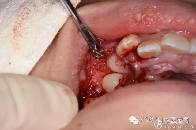 640.webp (19).jpg 640.webp (19).jpg