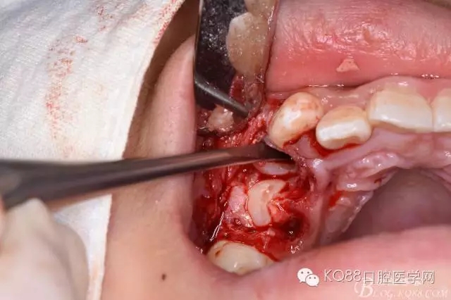 640.webp (23).jpg 640.webp (23).jpg