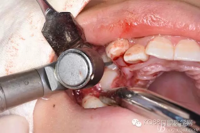 640.webp (24).jpg 640.webp (24).jpg