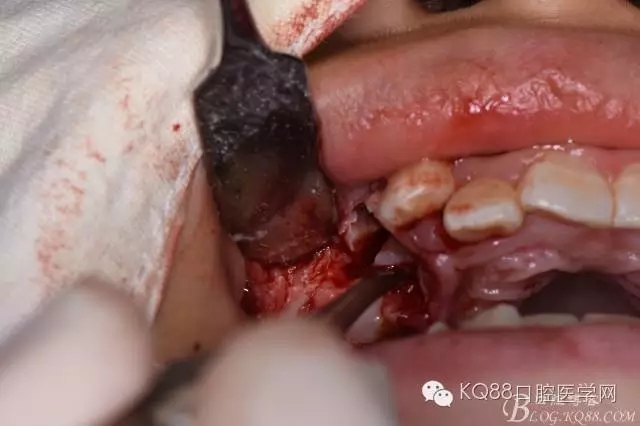 640.webp (25).jpg 640.webp (25).jpg