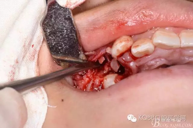 640.webp (28).jpg 640.webp (28).jpg