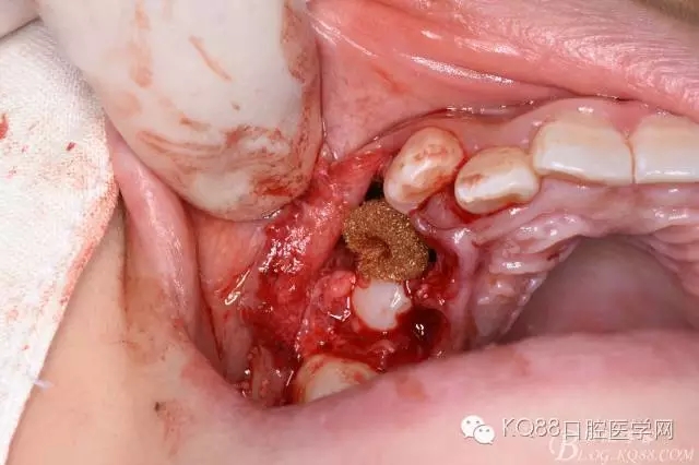 640.webp (30).jpg 640.webp (30).jpg