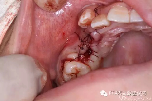 640.webp (32).jpg 640.webp (32).jpg