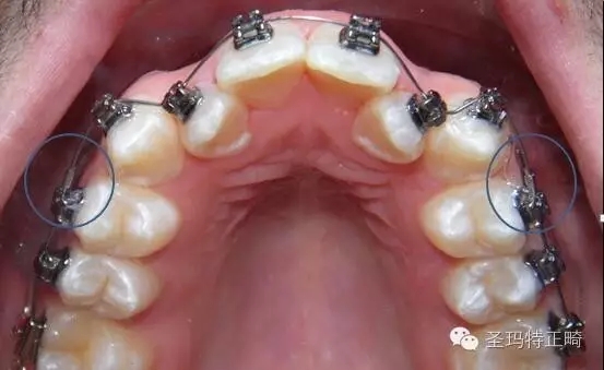 640.webp (3).jpg 640.webp (3).jpg