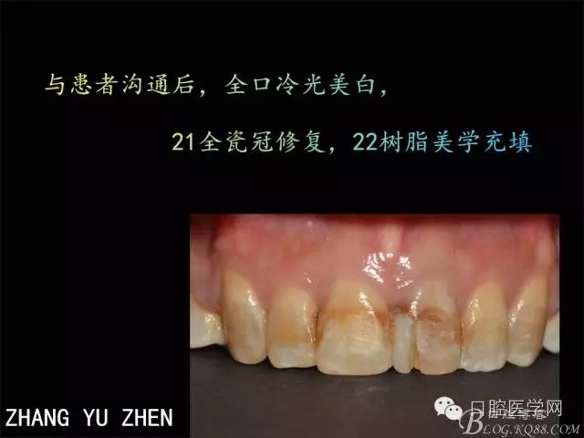 640.webp (1).jpg 640.webp (1).jpg