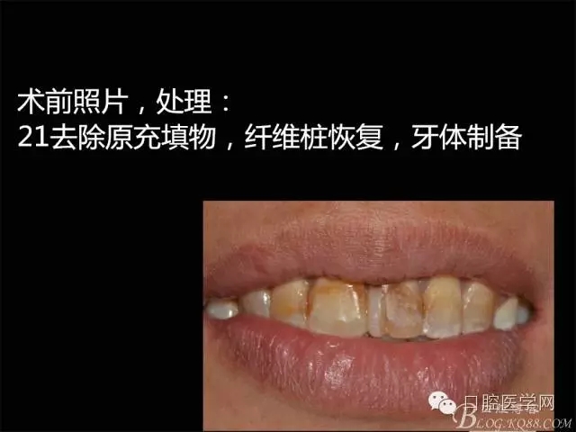 640.webp (2).jpg 640.webp (2).jpg