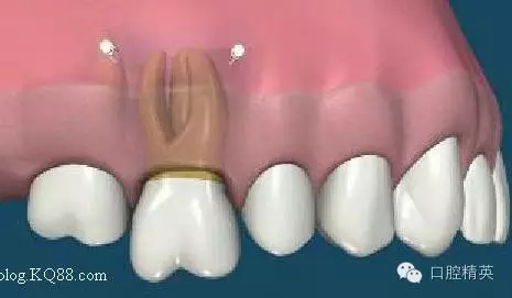 640.webp (2).jpg 640.webp (2).jpg