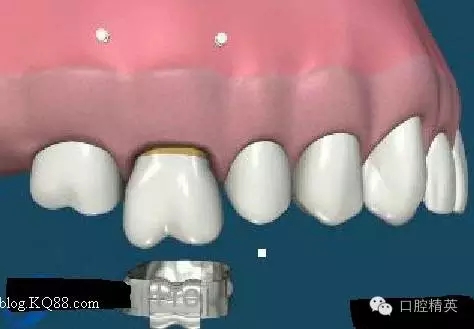 640.webp (3).jpg 640.webp (3).jpg