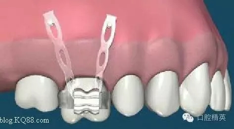 640.webp (5).jpg 640.webp (5).jpg