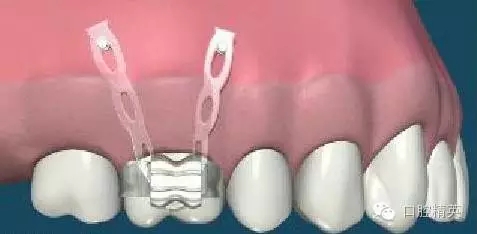 640.webp (6).jpg 640.webp (6).jpg