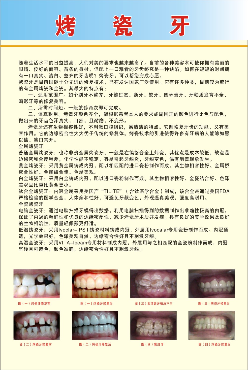 T1VblUFD0bXXXXXXXX_!!0-item_pic.jpg T1VblUFD0bXXXXXXXX_!!0-item_pic.jpg