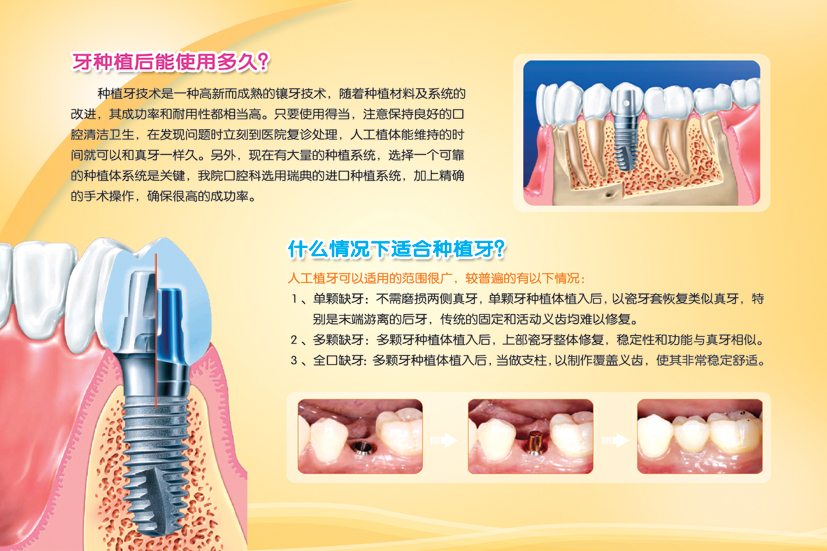 T18ltIXutiXXXXXXXX_!!0-item_pic.jpg T18ltIXutiXXXXXXXX_!!0-item_pic.jpg