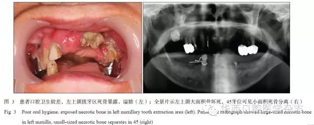 640.webp (3).jpg 640.webp (3).jpg