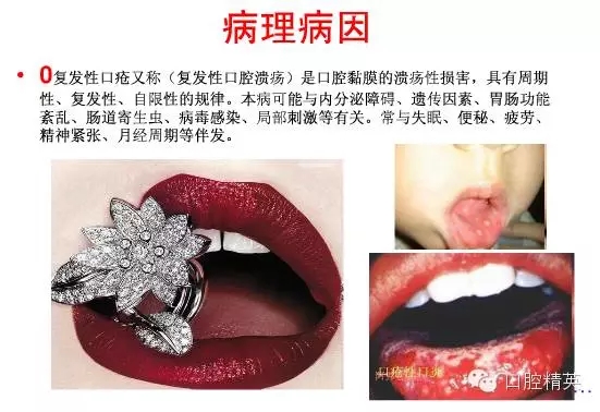 640.webp (2).jpg 640.webp (2).jpg