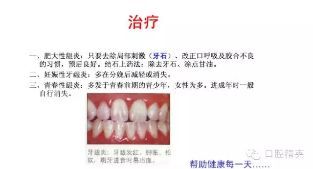 640.webp (23).jpg 640.webp (23).jpg