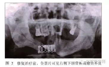 640.webp (7).jpg 640.webp (7).jpg