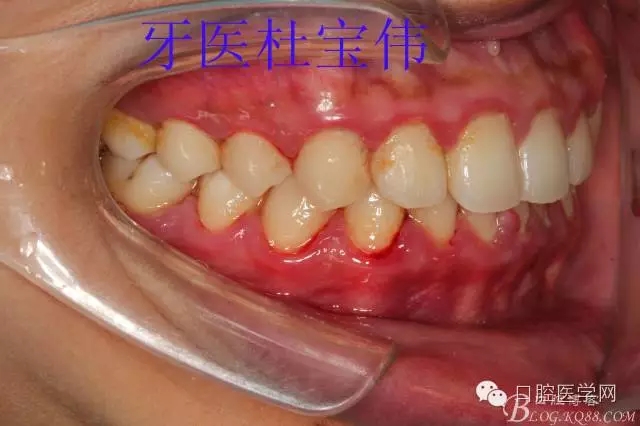 640.webp (1).jpg 640.webp (1).jpg