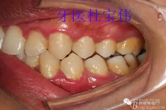 640.webp (2).jpg 640.webp (2).jpg