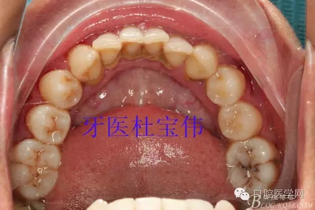 640.webp (4).jpg 640.webp (4).jpg