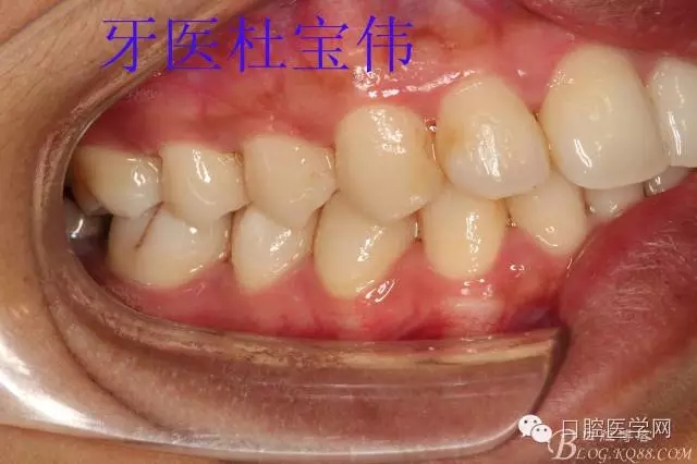 640.webp (6).jpg 640.webp (6).jpg