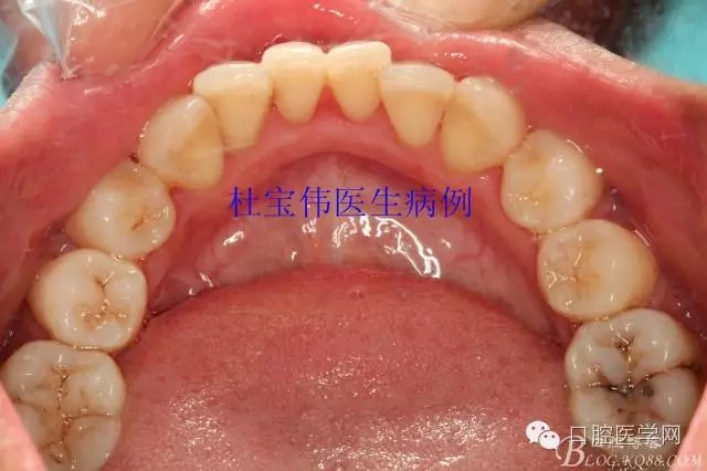 640.webp (9).jpg 640.webp (9).jpg