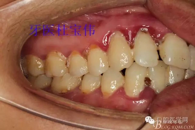 640.webp (11).jpg 640.webp (11).jpg