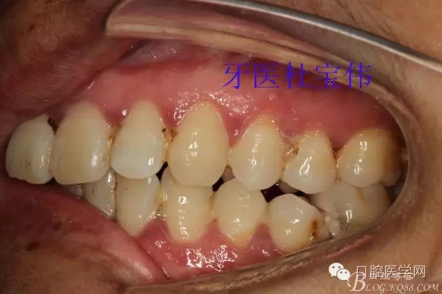 640.webp (12).jpg 640.webp (12).jpg